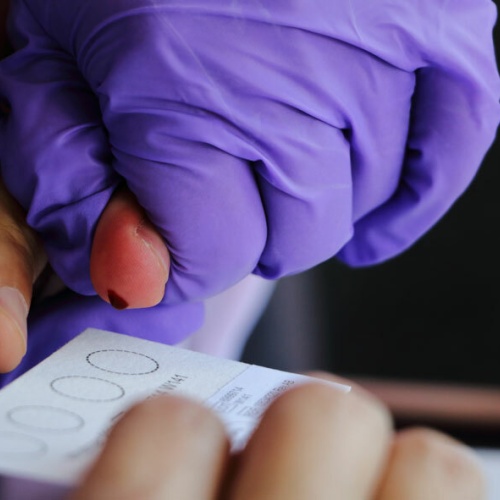 London peth alcohol testing